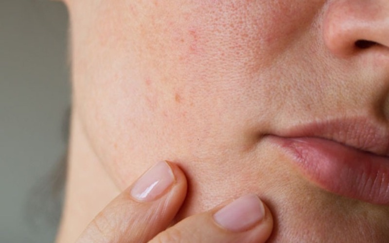 Sociedad Venezolana de Dermatología rechaza consejos de influencers sobre cuidados de la piel